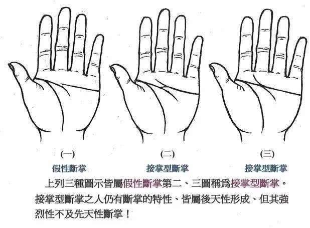 你知道什么是假断掌吗？也是有真假之分的吗